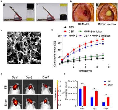 Topical application of daphnetin hydrogel for traumatic brain injury